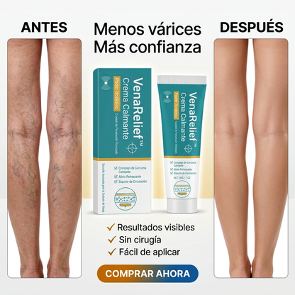 VenaRelief™ - Dile adiós a las várices